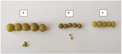 Characterization of Unripe Grapes (Vitis vinifera L.) and Its Use to Obtain Antioxidant Phenolic Compounds by Green Extraction